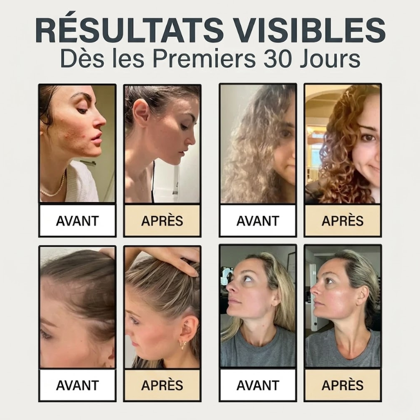 Sauvez Votre Peau, Vos Cheveux et Votre Santé du Désastre avec Nesqua™